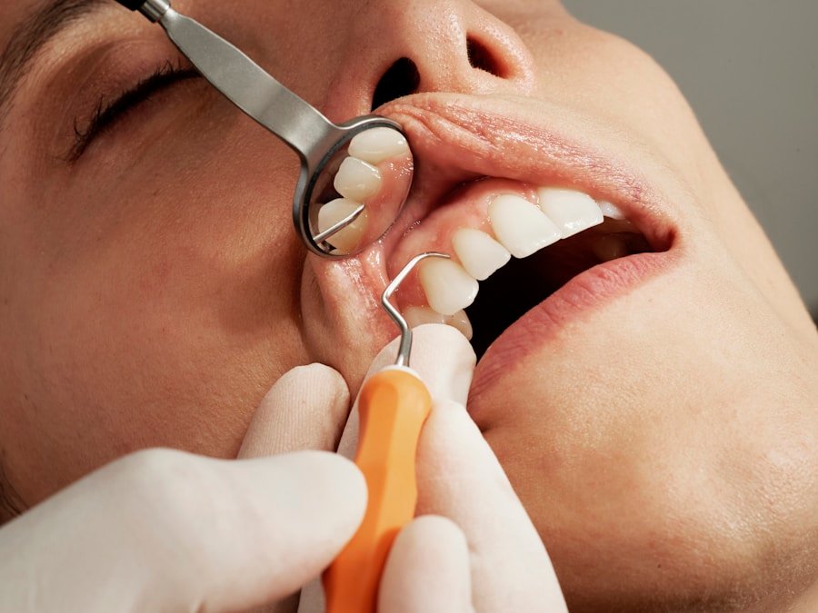Clear aligner smile care
